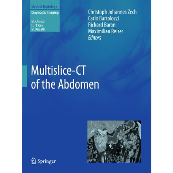 

Multislice-CT of the Abdomen / Zech