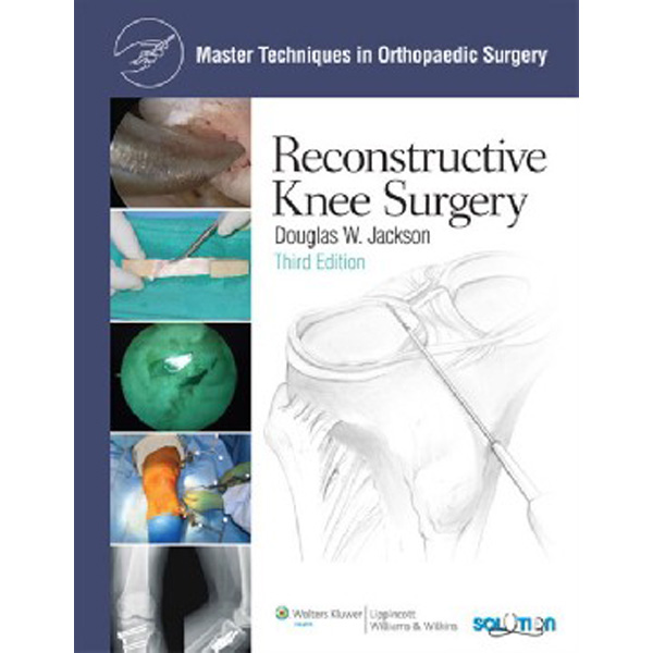 

Mtos: recon knee surgery 3e cb / Jackson