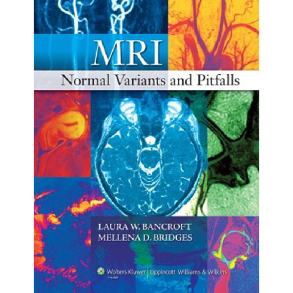 

MRI Normal Variants and Pitfalls / Bancroft