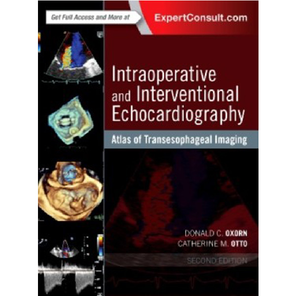 

Intraoperative and Interventional Echocardiography / Oxorn Donald