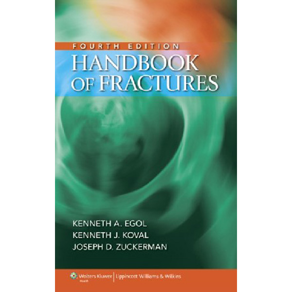 

Handbook of Fractures / Egol