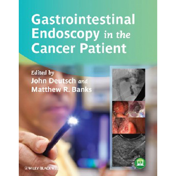 

Gastrointestinal Endoscopy in the Cancer Patient / Deutsch