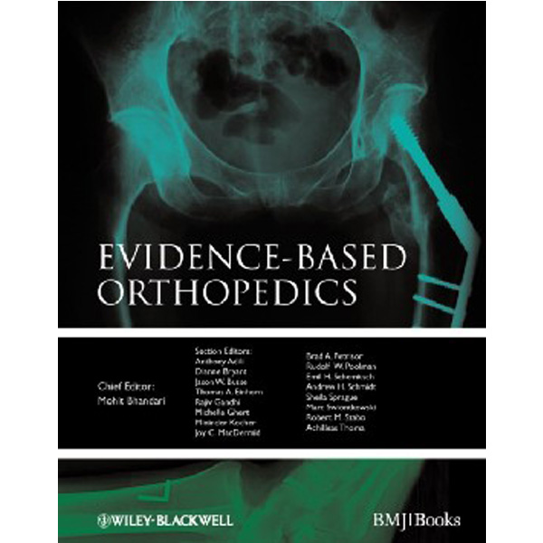 

Evidence-based Orthopedics / Mohit Bhandari