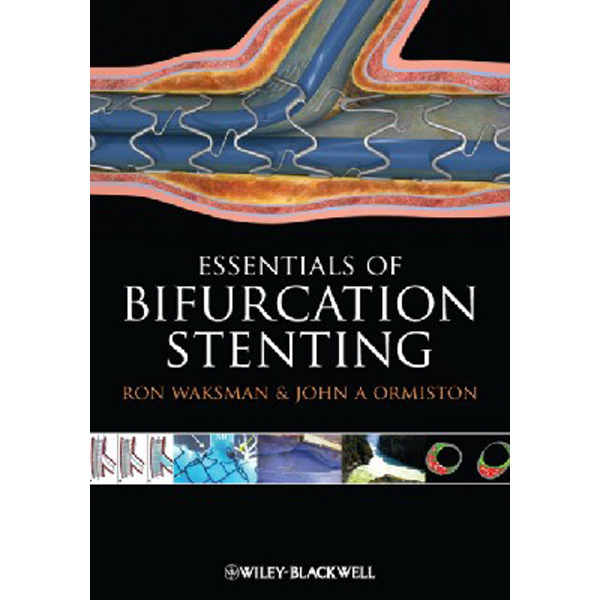 

Essentials of Bifurcation Stenting / Waksman