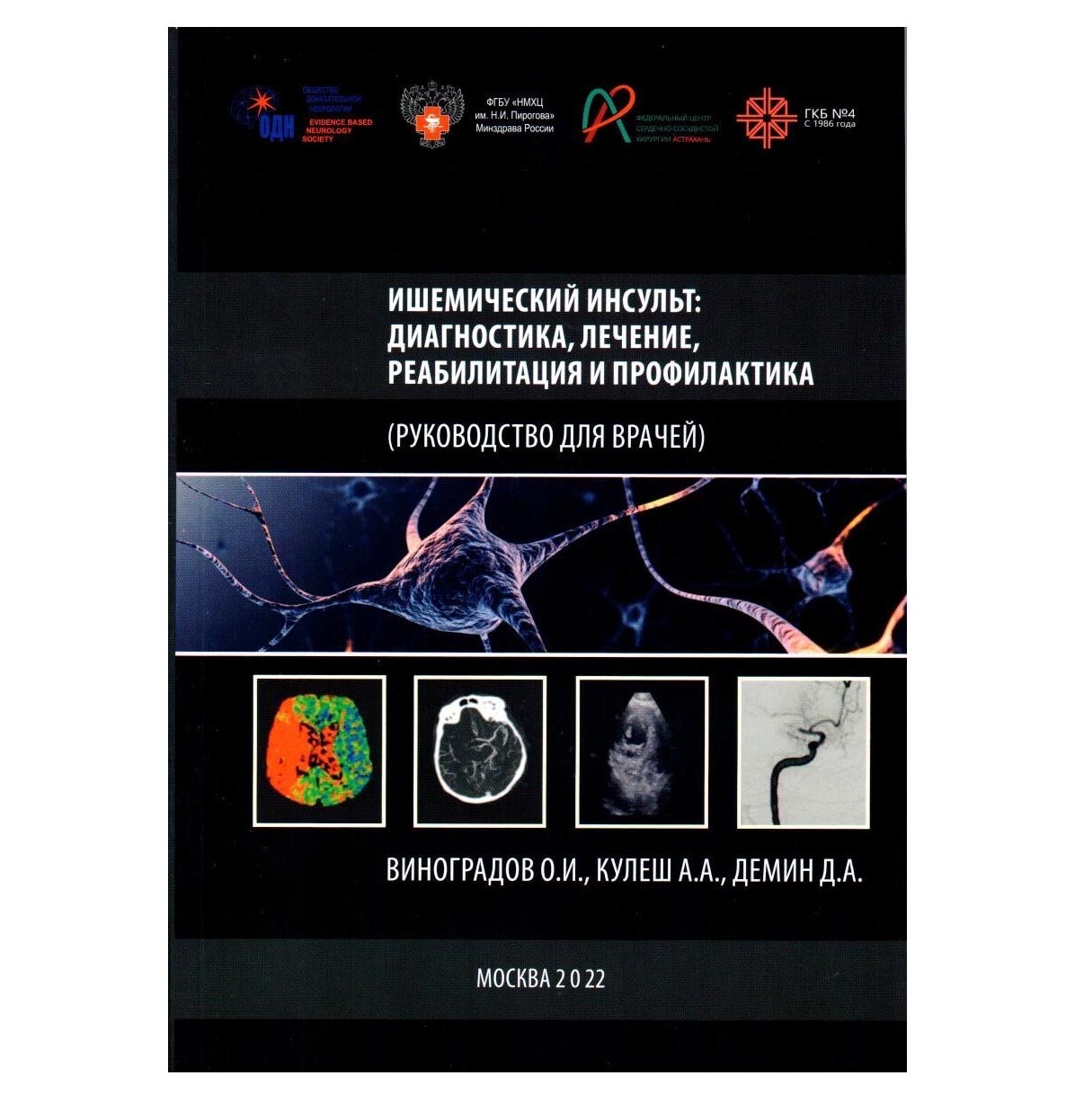 

Книга Ишемический инсульт: диагностика, лечение, реабилитация и профилактика.…