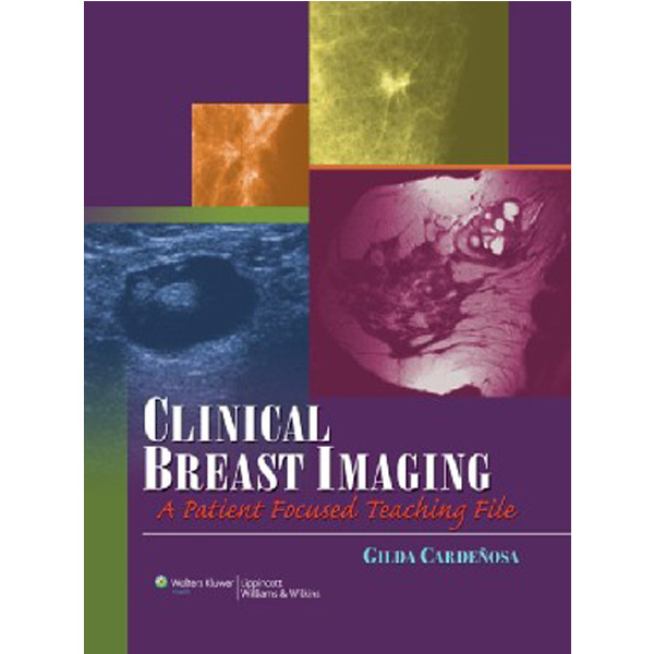 

Clinical Breast Imaging: A Patient Focused Teaching Atlas / Cardenosa