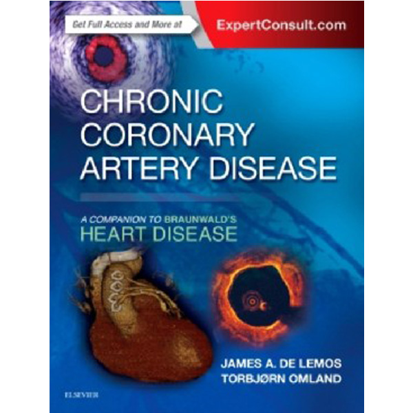 

Chronic Coronary Artery Disease / Delemos James