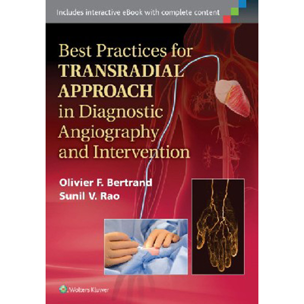 

Best Practices for Transradial Approach in Diagnostic Angiography and Interventio...