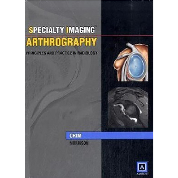 

Arthrography: Principles & Practice in Radiology Published by Amirsys® / Crim