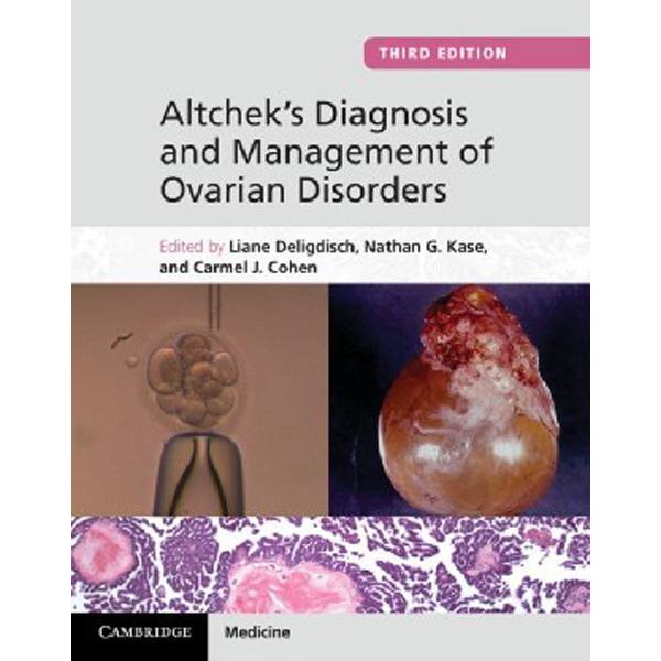 

Altchek's Diagnosis and Management of Ovarian Disorders / Deligdisch