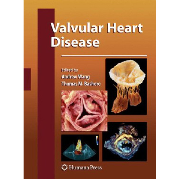 

Valvular Heart Disease / Andrew Wang, Thomas Bashore