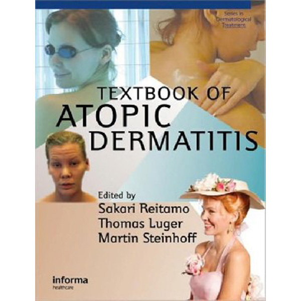 

Textbook Atopic Dermatitis / Reitamo