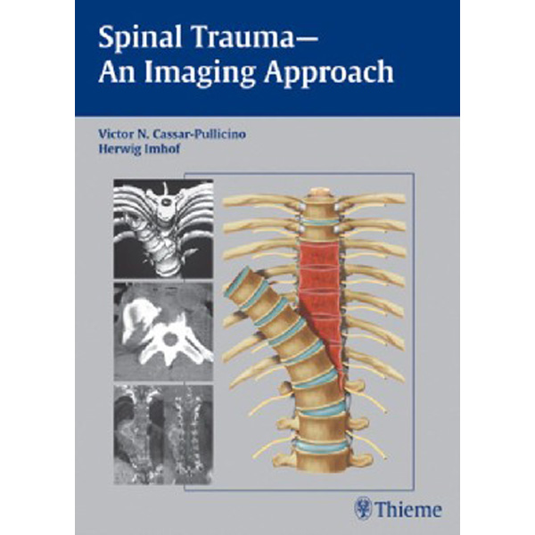 

Spinal Trauma - An Imaging Approach / Victor N. Cassar-Pullicino