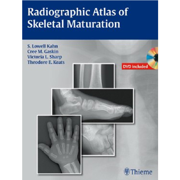 

Radiographic Atlas of Skeletal Maturation / S. Lowell Kahn