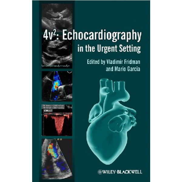 

Practical Manual of Echocardiography in the Urgent Setting / Fridman