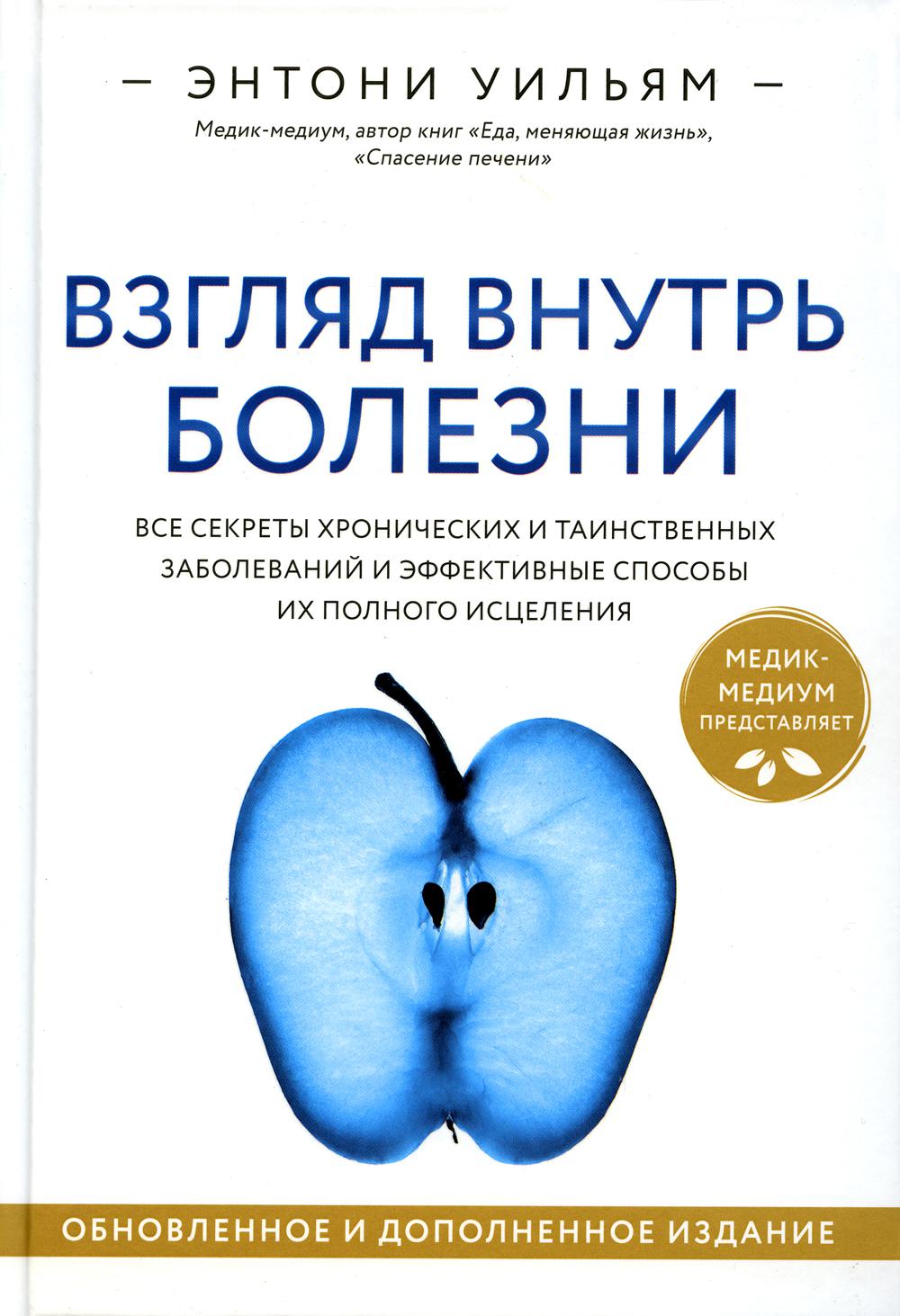 

Взгляд внутрь болезни. Все секреты хронических и таинственных заболеваний и эффек...