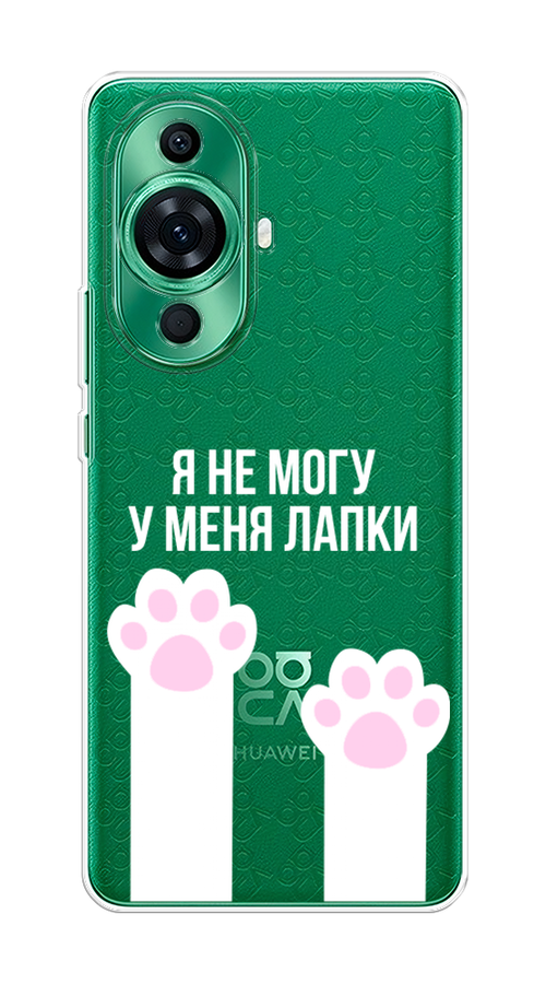 

Чехол на Huawei Nova 11 Pro "У меня лапки", Белый;розовый, 6121350-6