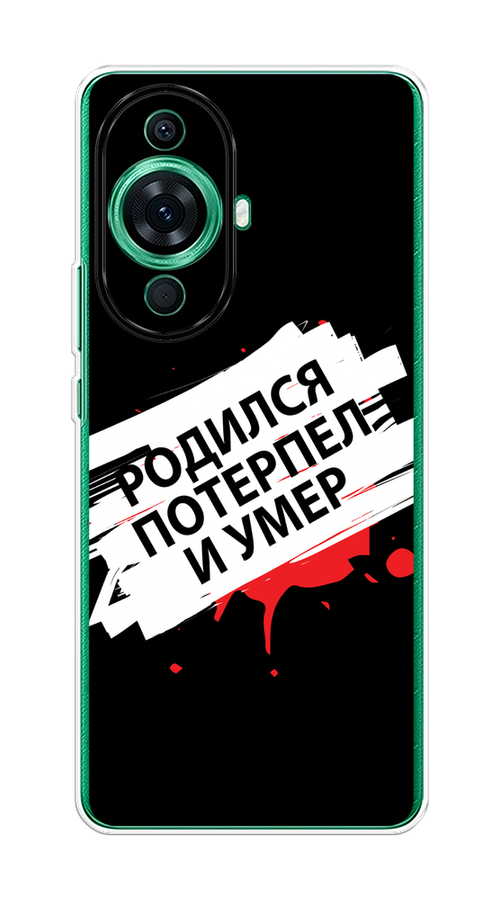 

Чехол на Huawei Nova 11 Pro "Родился потерпел и умер", Белый;красный;черный, 6121350-6