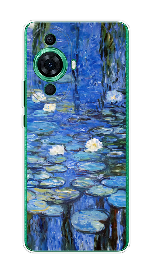 

Чехол на Huawei Nova 11 Pro "Нарисованный пруд", Синий;зеленый, 6121350-4