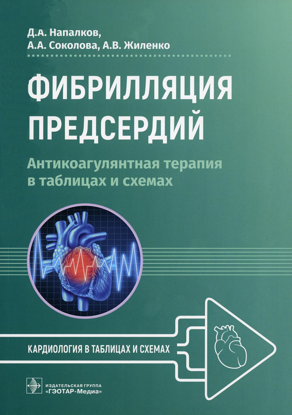 

Фибрилляция предсердий