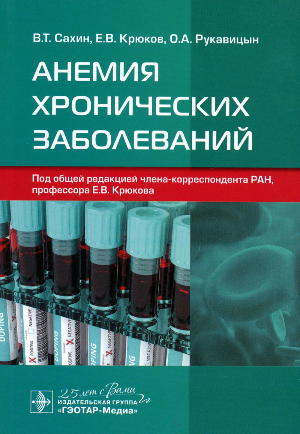 

Анемия хронических заболеваний