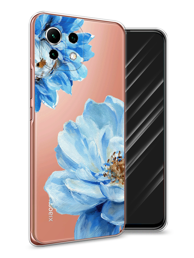 

Чехол Awog на Xiaomi Mi 11 Lite "Голубые клематисы", Разноцветный, 310250-8