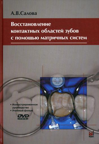 

Восстановление контактных областей зубов с помощью матричных систем