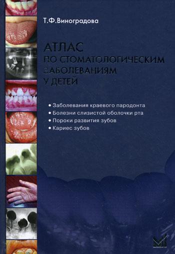 

Атлас по стоматологическим заболеваниям у детей