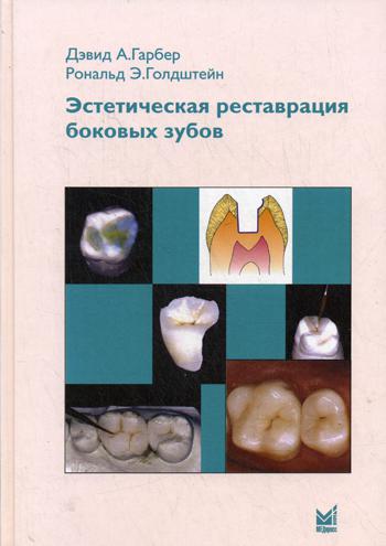 

Эстетическая реставрация боковых зубов. Вкладки и накладки