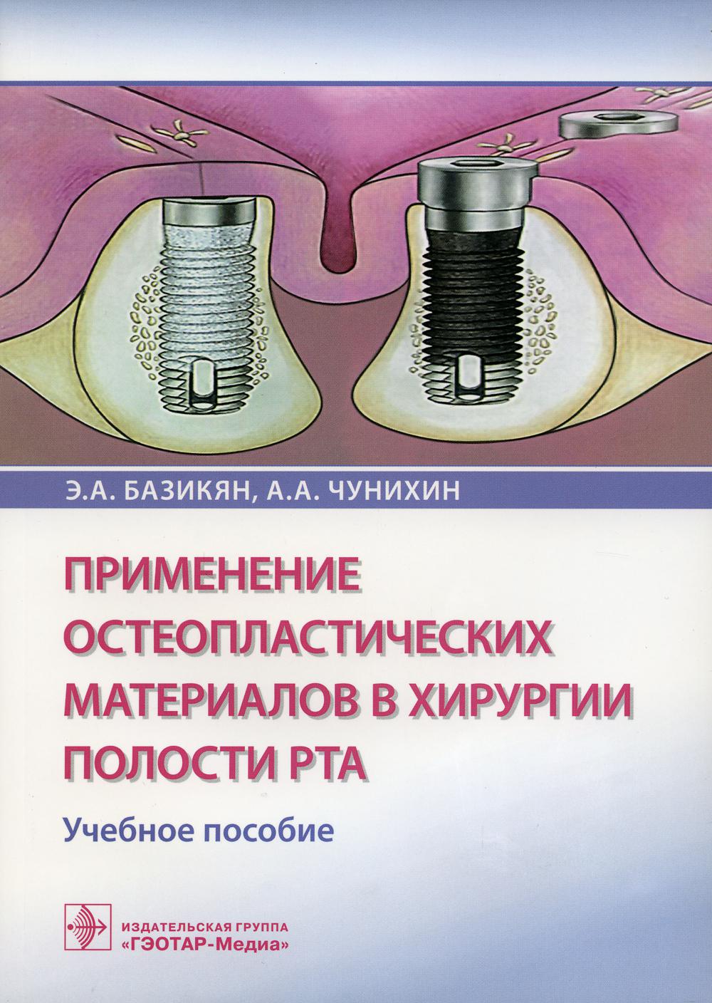 

Применение остеопластических материалов в хирургии полости рта
