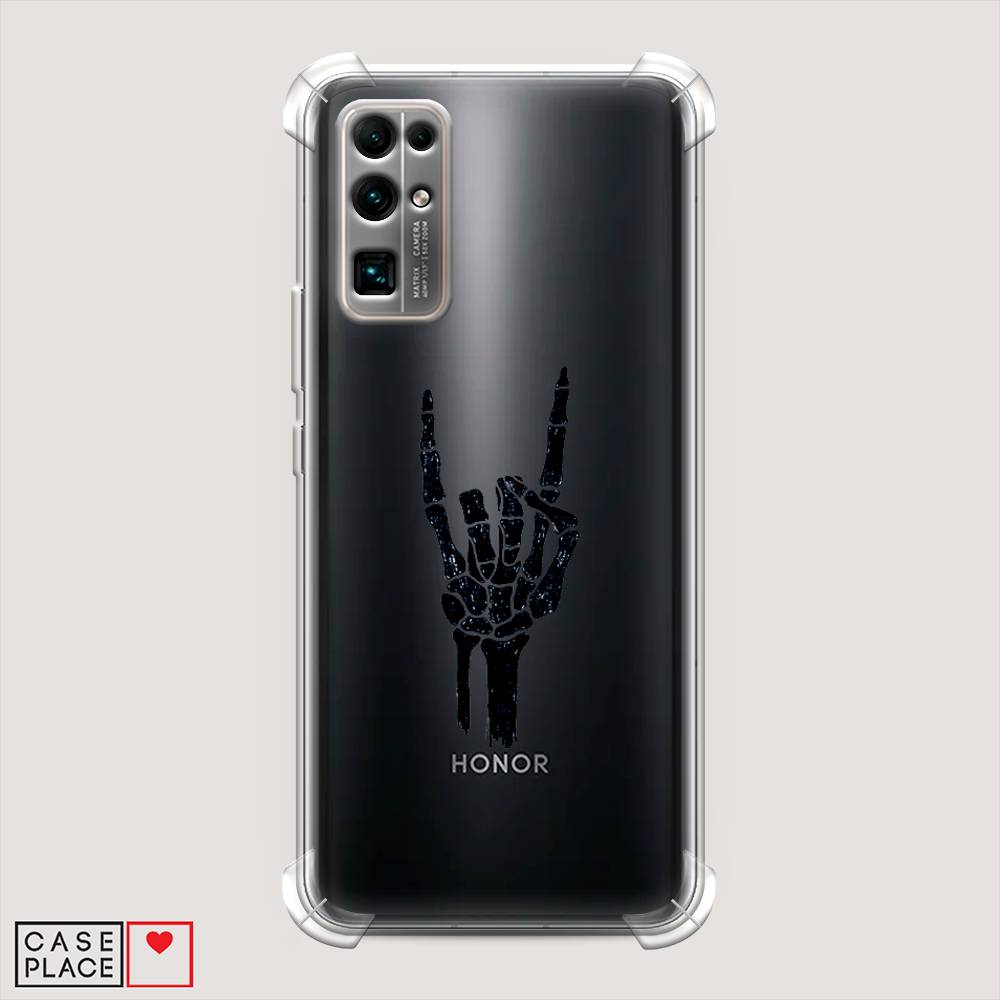 

Чехол Awog на Honor 30 "Rock for a skeleton", Черный;прозрачный, 612151-1