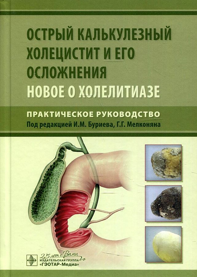 

Острый калькулезный холецистит и его осложнения. Новое о холелитиазе. Руководство