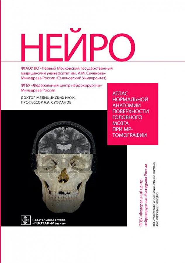 

Атлас нормальной анатомии поверхности головного мозга при МР-томографии