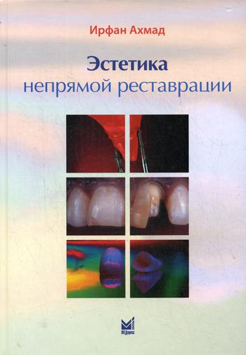 

Эстетика непрямой реставрации