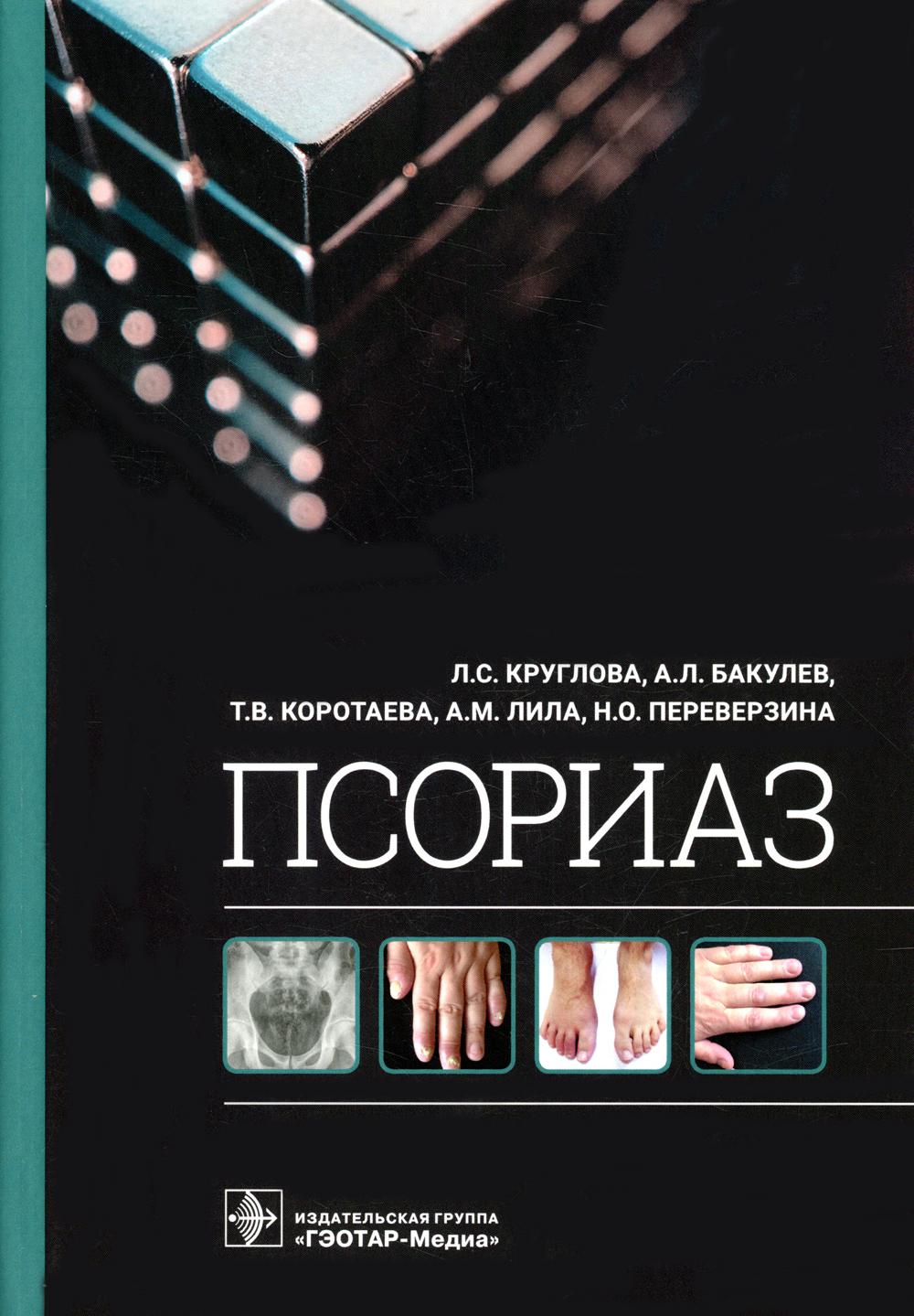 

Псориаз