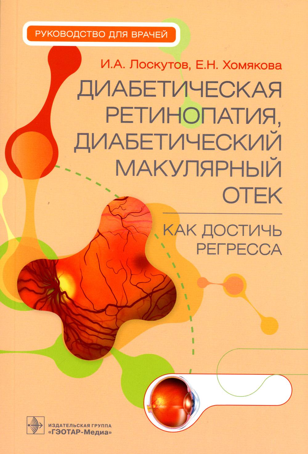 

Диабетическая ретинопатия, диабетический макулярный отек - как достичь регресса