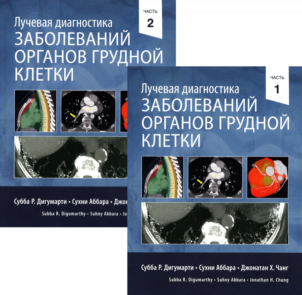 фото Книга лучевая диагностика заболеваний органов грудной клетки изд.панфилова