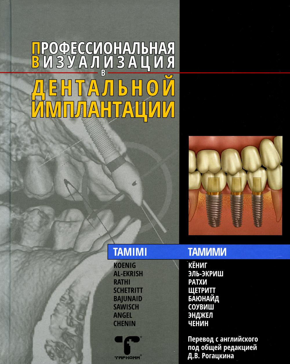 фото Книга профессиональная визуализация в дентальной имплантации таркомм