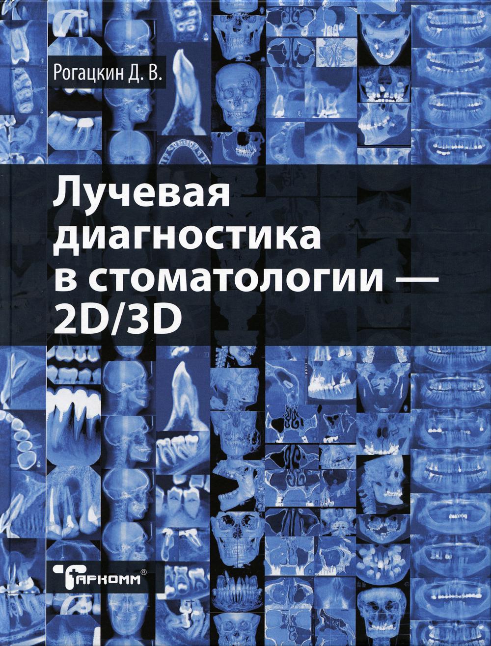 

Книга Лучевая диагностика в стоматологии: 2D/3D