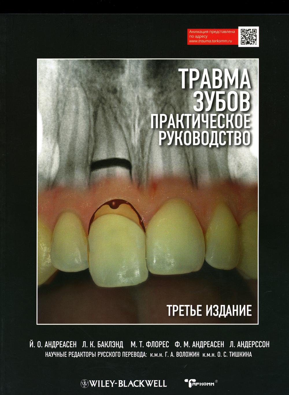 

Травма зубов