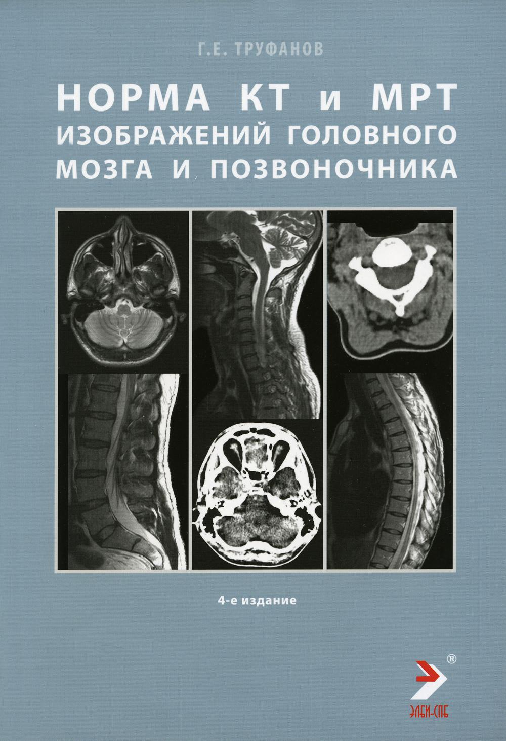 

Норма КТ- и МРТ- изображений головного мозга и позвоночника