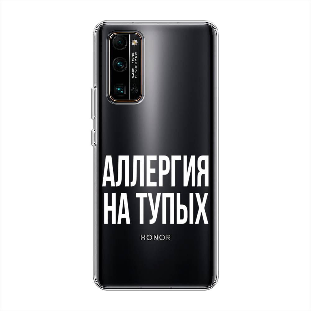 

Чехол Awog на Honor 30 Pro Plus "Аллергия на тупых", Прозрачный;бежевый, 612250-6