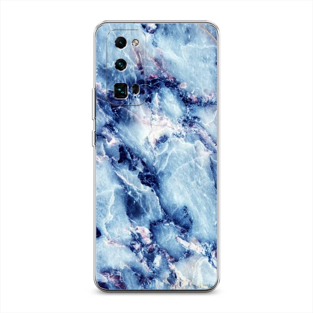 Чехол на Honor 30 Pro Plus  