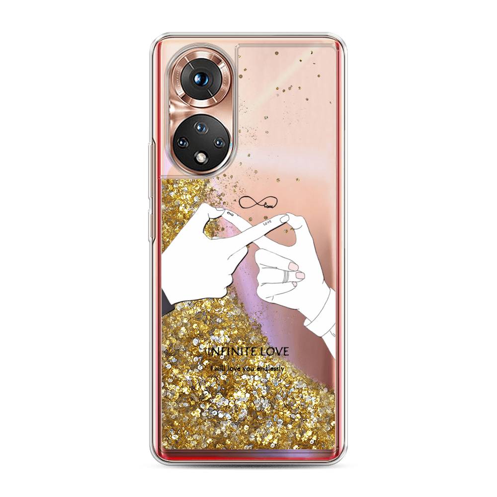 

Чехол Awog на Huawei Nova 9 "Любовь навсегда", Бежевый, 6106190-1