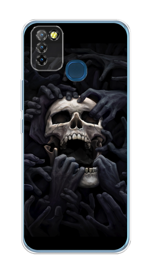 

Чехол Awog на Infinix HOT 10 Lite "Череп 29", Разноцветный, 3100350-9