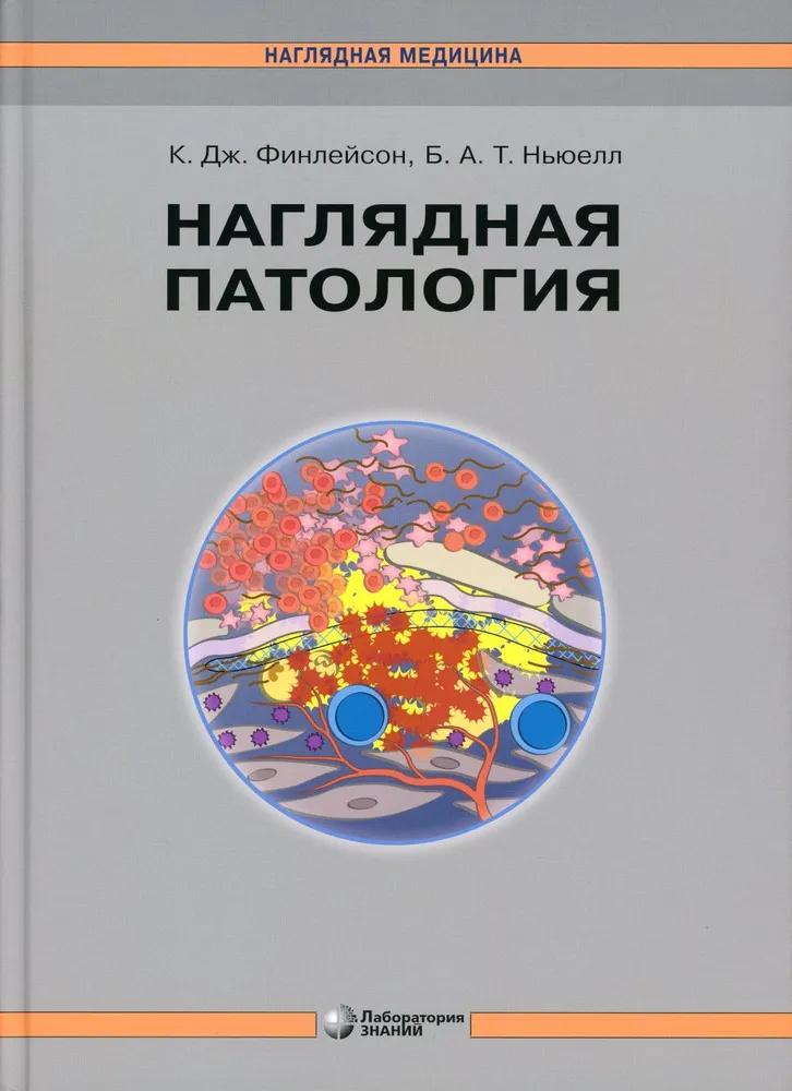 

Наглядная патология
