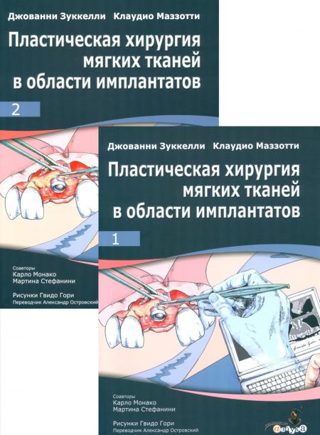 

Пластическая хирургия мягких тканей в области имплантов. В 2 т