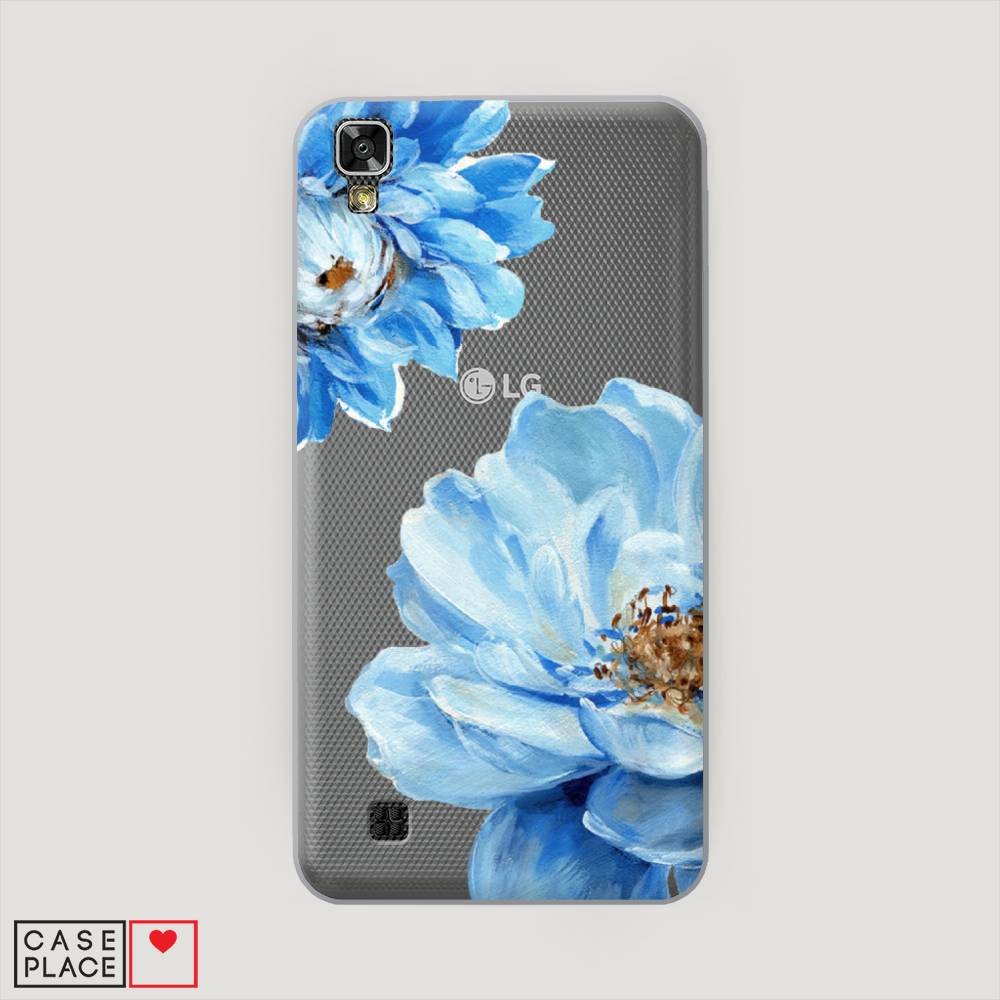 

Чехол Awog на LG X Power (K220DS) "Голубые клематисы", Голубой, 82350-8