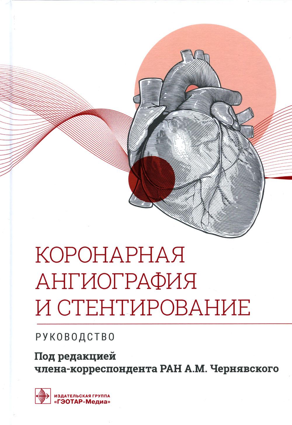 

Коронарная ангиография и стентирование