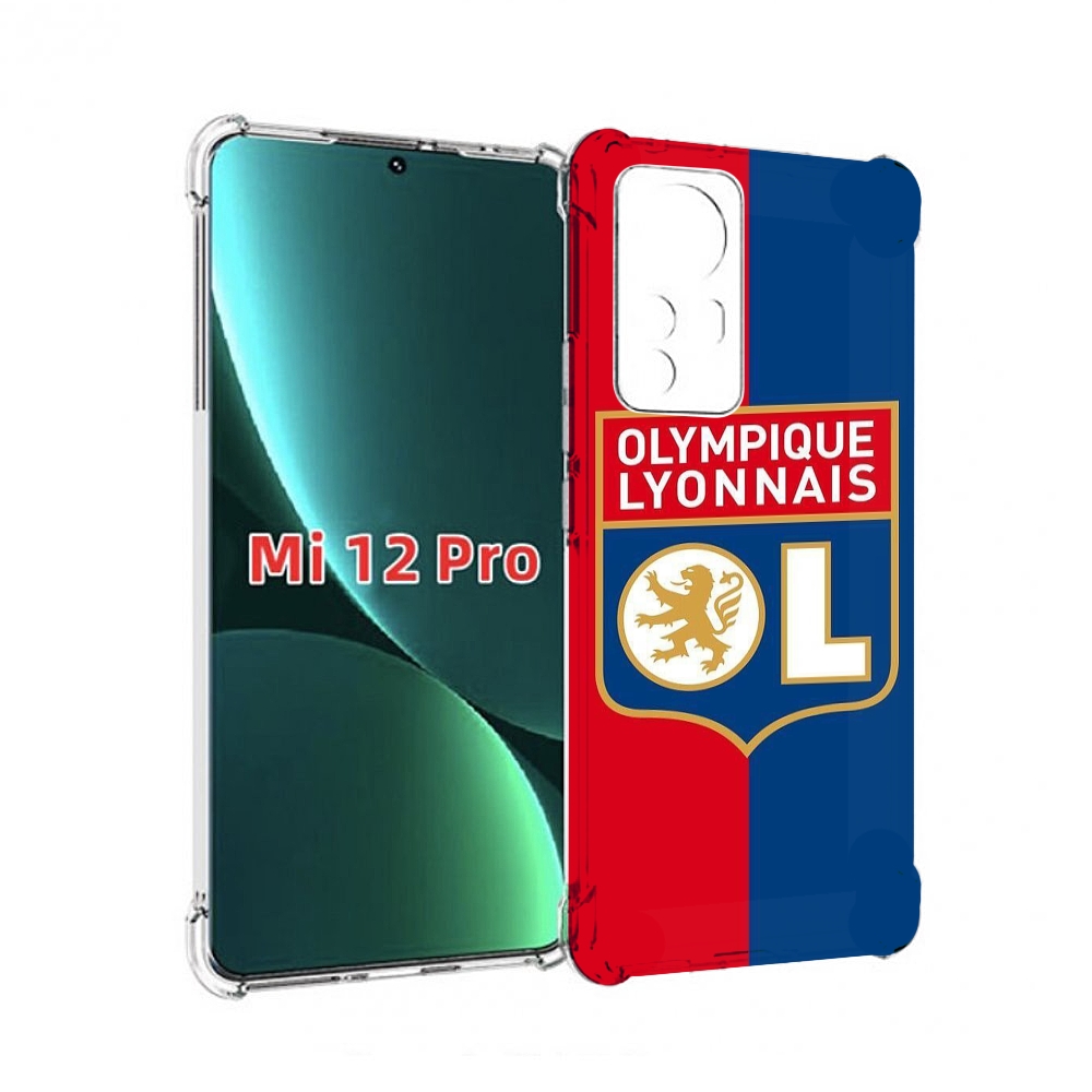 

Чехол MyPads фк лион эмблема для Xiaomi 12S Pro, Прозрачный, Tocco
